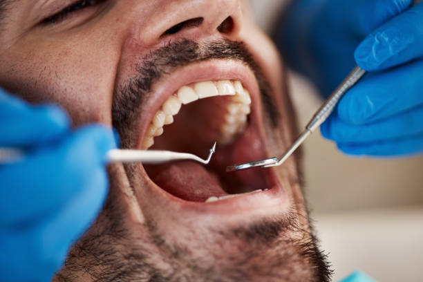 Best Emergency Cosmetic Dentistry in Hamilton, IN